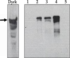 "Immunoprecipitation of
Dyrk from 293T transfected cells.
Immunoprecipitation with
- 1) control Ab, 2)
Anti-MNP 2 µg/ml, 3)
Exalpha’s anti-Dyrk 2
µg/ml, 4) Exalpha’s
anti-Dyrk 10 µg/ml, 5)
competitor’s anti-Dyrk Ab 10 µg/ml, Western blot performed with Exalpha’s anti-Dyrk Ab at 2 µg/ml."